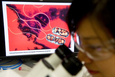 A person looks through a microscope while a screen in the background displays a coloured image of bacteria on a red background