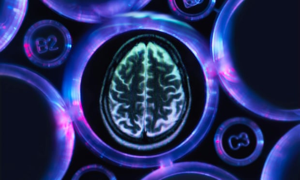 the guardian - number-adults-with-dementia-exceed-150-million-2050-study https://www.theguardian.com/society/2022/jan/06/number-adults-with-dementia-exceed-150-million-2050-study