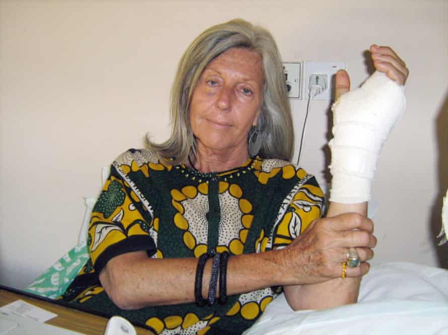 Hard breaks: Gallmann holds her arm after her hadn was crushed by illegal grazers in 2009.