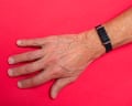 Phil Daoust wearing a Hilo bracelet.