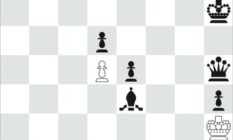 Magnus Carlsen About Why He HATES Garry Kasparov
