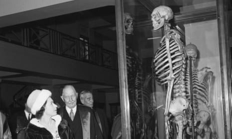 The Queen looks at the skeleton of Charles Byrne on a visit to the Hunterian Museum, London, in 1962.