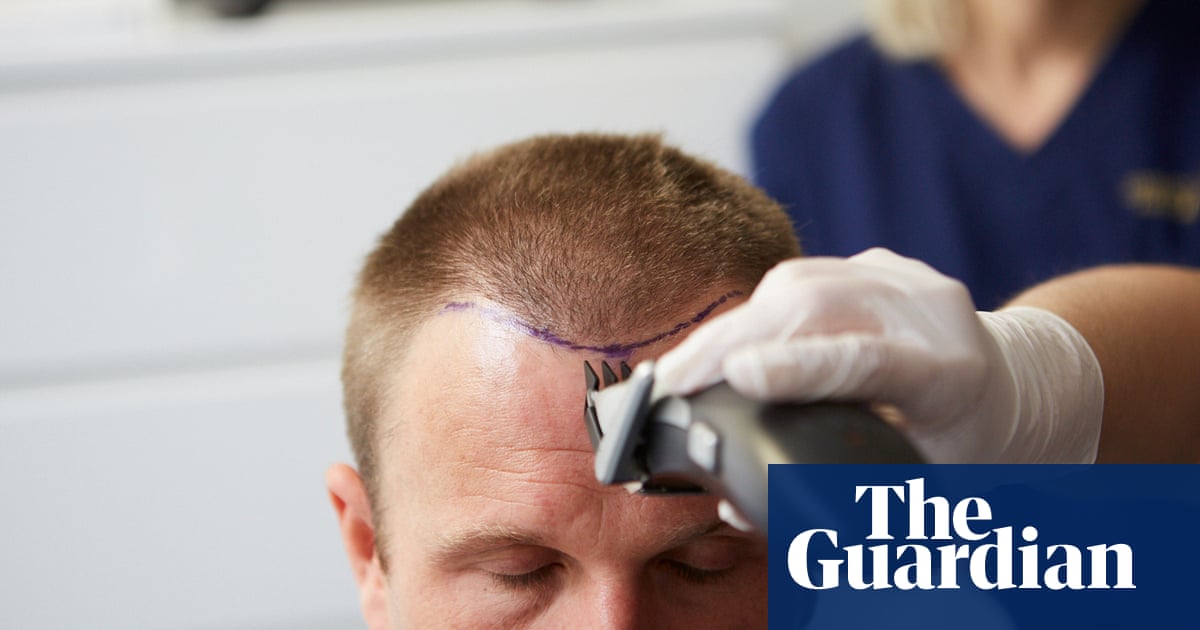The Hair Wellness Industry Men Said They Would Rather Have A