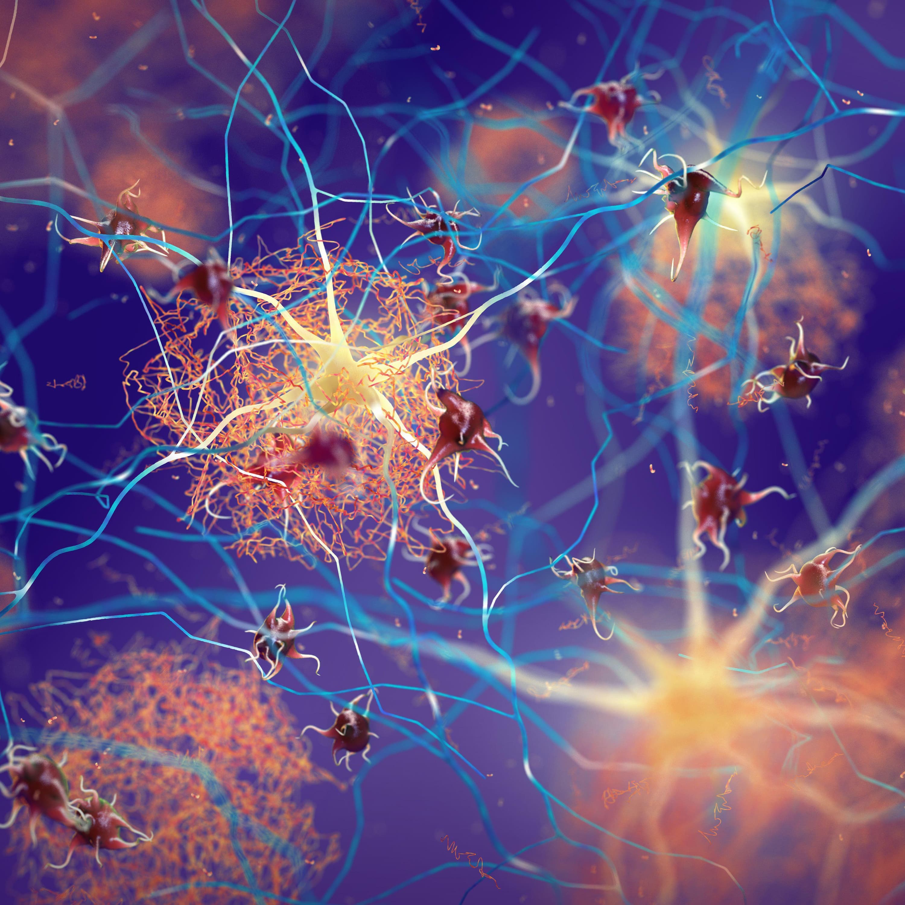 Is there hope on the horizon for patients with Alzheimer’s?