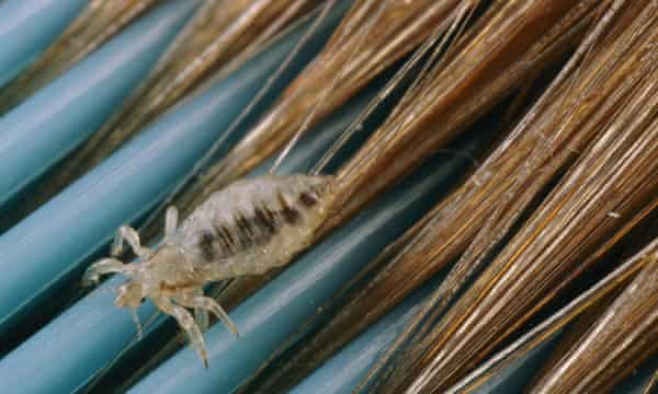 Itchy and scratchy – why the battle against head lice just got serious | Health & wellbeing | The Guardian Itchy and scratchy – why the battle against head lice just got serious | Health & wellbeing | The Guardian