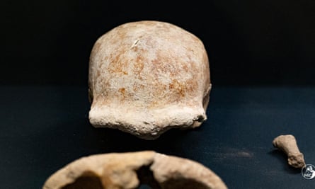 A frontal view of a female skull and a right hand thumb metacarpal bone are among the fossilised remains.