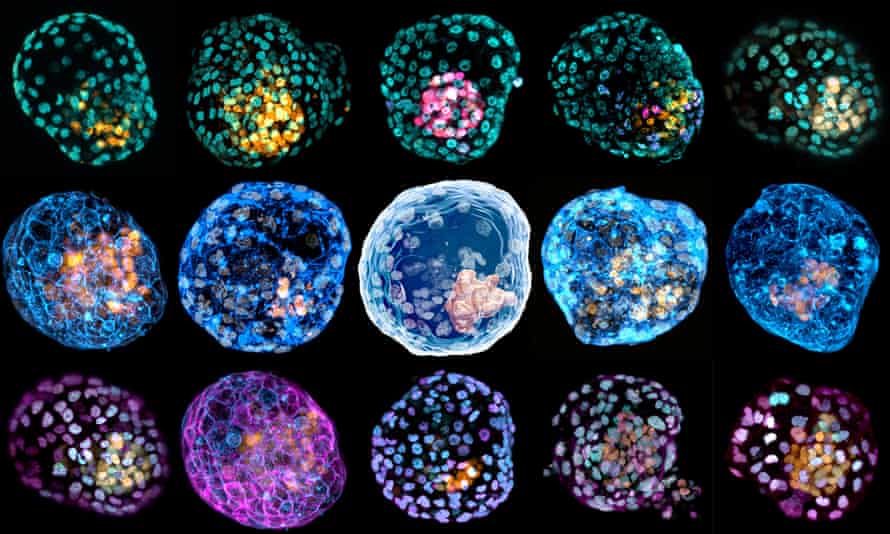 Matrix of stained blastoids.  Scientists say their cell research could help understand the causes of early miscarriage and infertility