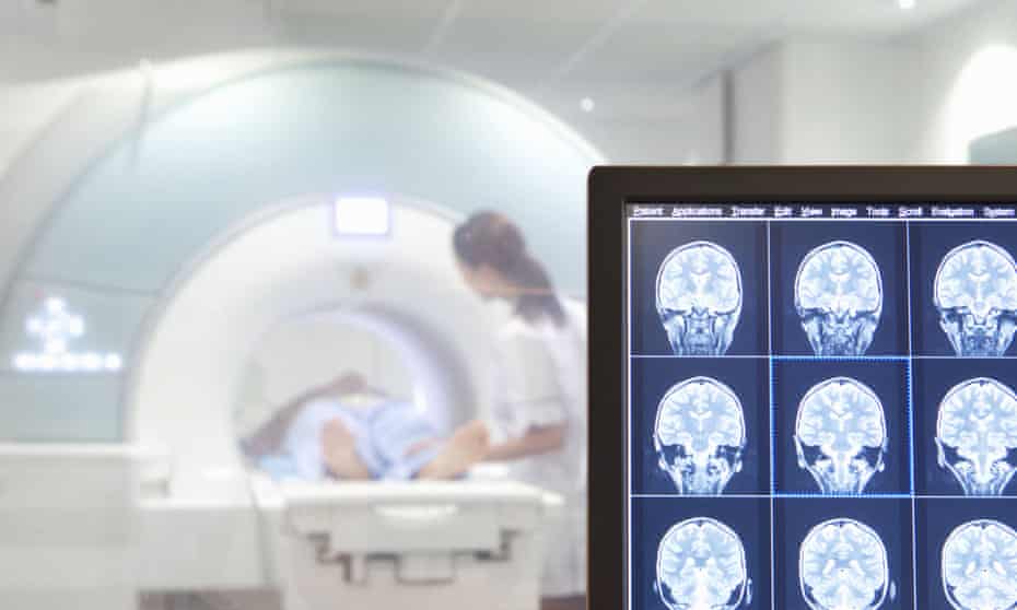 Brain scans on a computer monitor