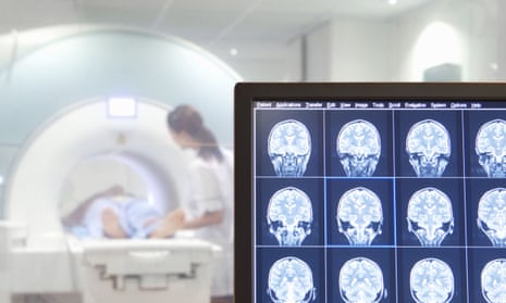 Digital brain scan on a computer monitor with MRI scanner in the background