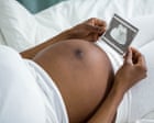 Stress from racism may help explain why black women more likely to die in childbirth, study finds