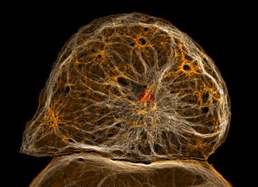 Dedifferentiated liver endothelial cell