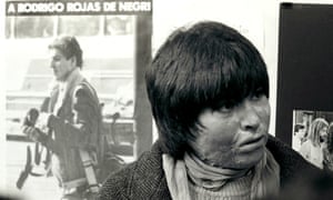 Carmen Gloria Quintana was left disfigured after soldiers doused her and Rodrigo Rojas with petrol and set them on fire. 2200.jpg?width=300&quality=85&auto=forma