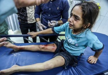 A young girl wearing a T-shirt that says ‘hope’ sits on a hospital bed crying. She is covered in dirt and dust and is bleeding from her leg