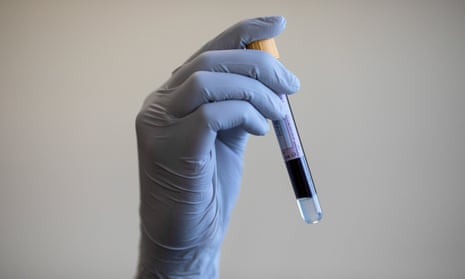 a gloved hand holding a test tube containing a blood sample
