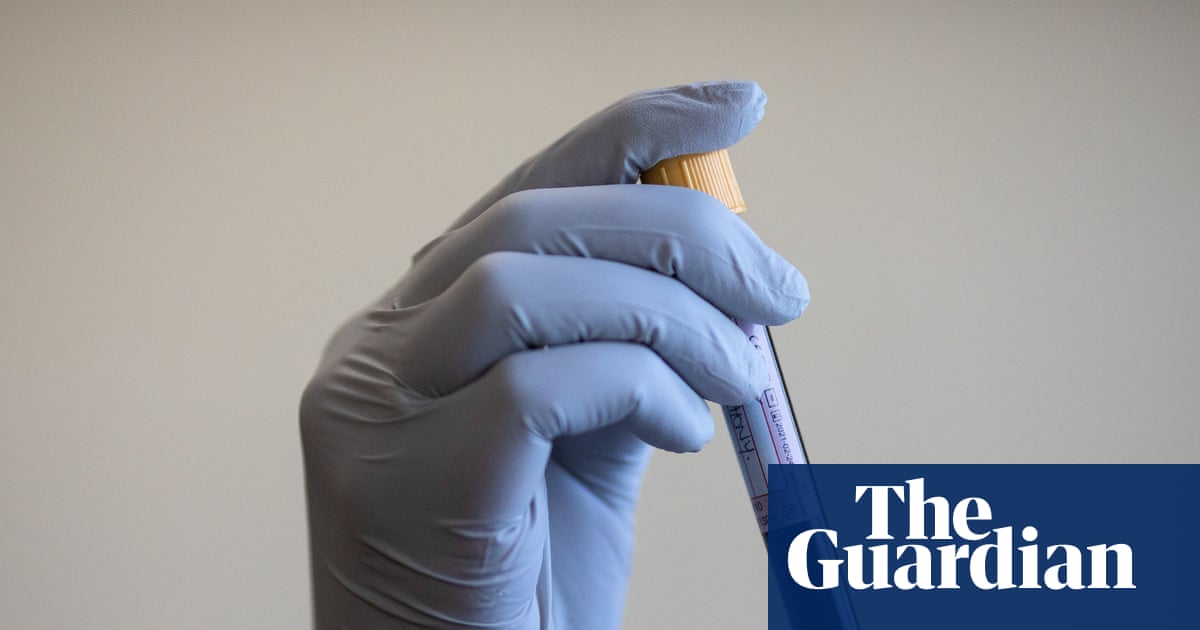 Experts consider ‘targeted’ prostate cancer screening to reduce UK deaths