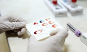 Cancer diagnosis using blood tests would be earlier and less invasive. 