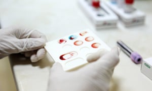 Cancer diagnosis using blood tests would be earlier and less invasive.