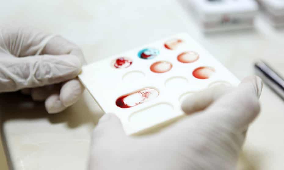 a blood test in a lab