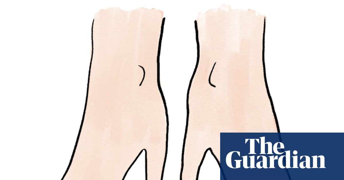 Is it true that wearing heels changes the shape of your feet?