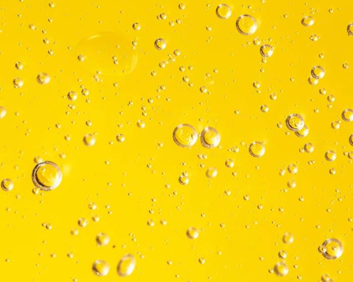 Is having urine the color of Mountain Dew normal?