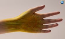 Yellowing, transparent skin on a hand and forearm