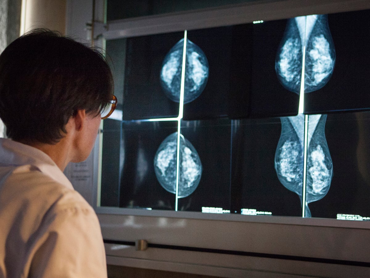 I M An Oncologist Who Got Breast Cancer This Is What I Learned