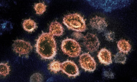 An electron microscope image shows Sars-Cov-2 virus particles.