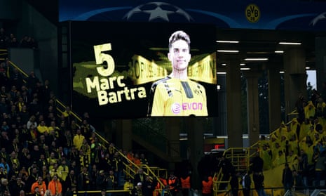 A picture of Dortmund’s Spanish defender Marc Bartra who was injured during an attack is screened before the Champions League quarter-final first-leg defeat to Monaco.