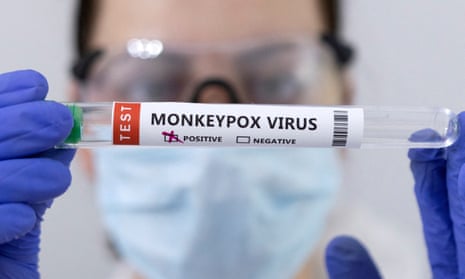 test tubes labelled "Monkeypox virus positive
