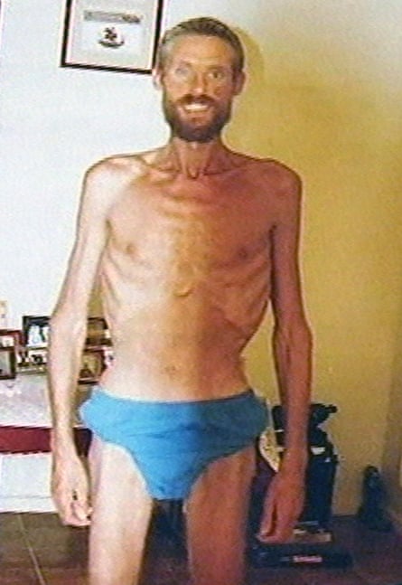 In this still image from video, made available Saturday April 15, 2006, showing Ricky Megee in Darwin, Australia, as he appeared shortly after being rescued, after he was stranded in the Australian Outback for three months and surviving by eating mainly frogs and lizards.