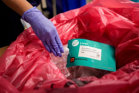 A liver is prepared for transport after it has been removed from an organ donor.