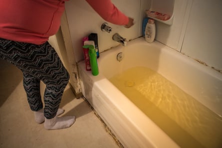 Tara Sakanee runs a bath at her home in Neskantaga. She says the water is usually varying degrees of yellow in colour and complains of itching and dry skin after showers.
