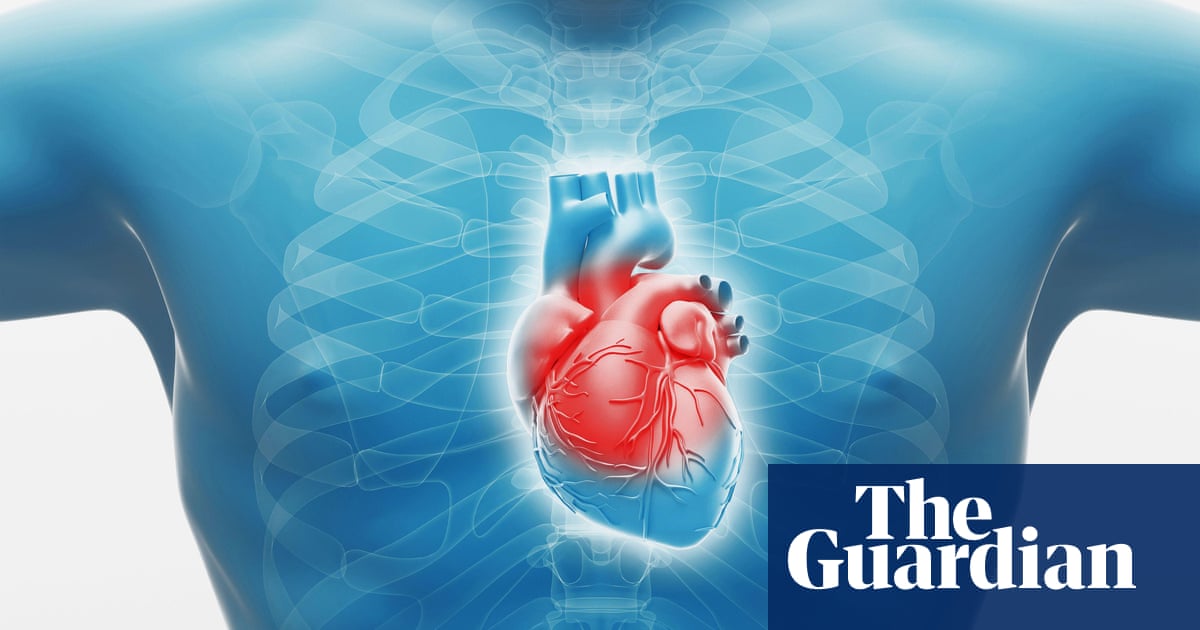 Combination of two cheap drugs could save lives after heart attack, study finds