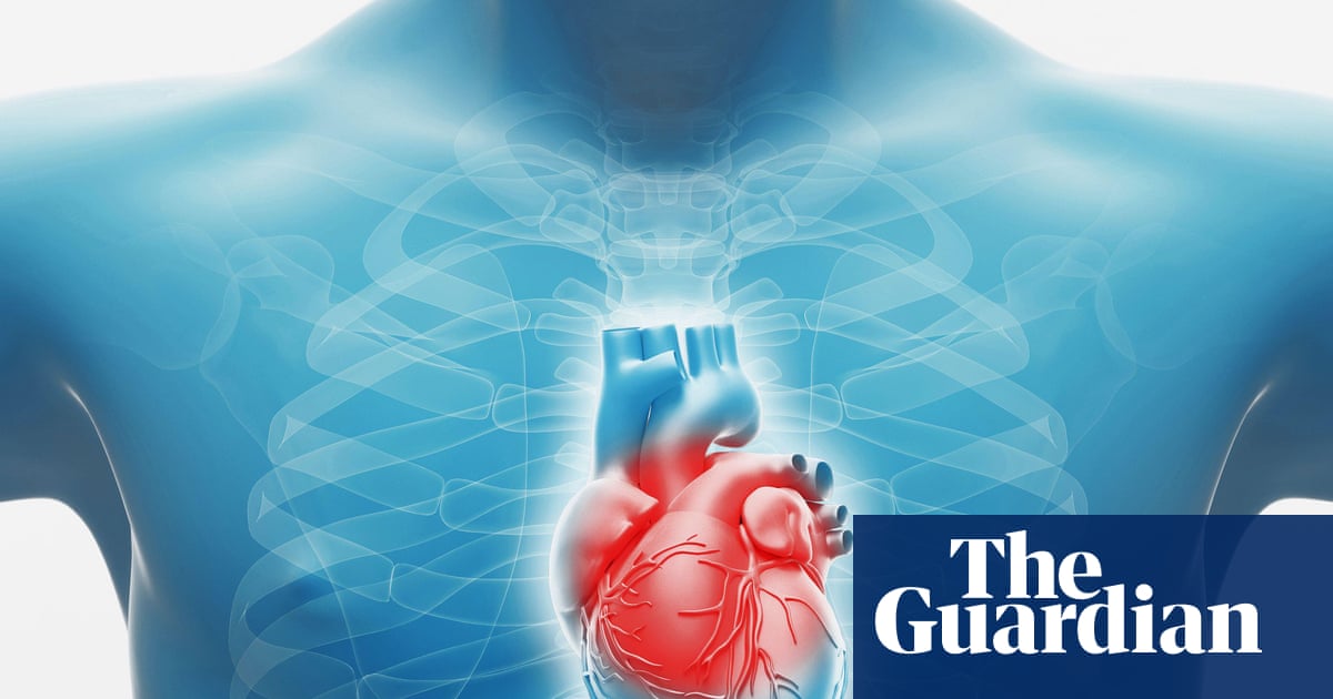 Nationwide Implementation of Heart Disease Clinics Urged to Tackle Ethnic Disparities in Treatment Nationwide Implementation of Heart Disease Clinics Urged to Tackle Ethnic Disparities in Treatment