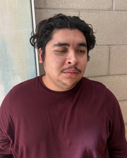 Man with swollen eye