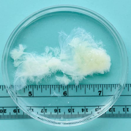 large amount of whitish material in petri dish