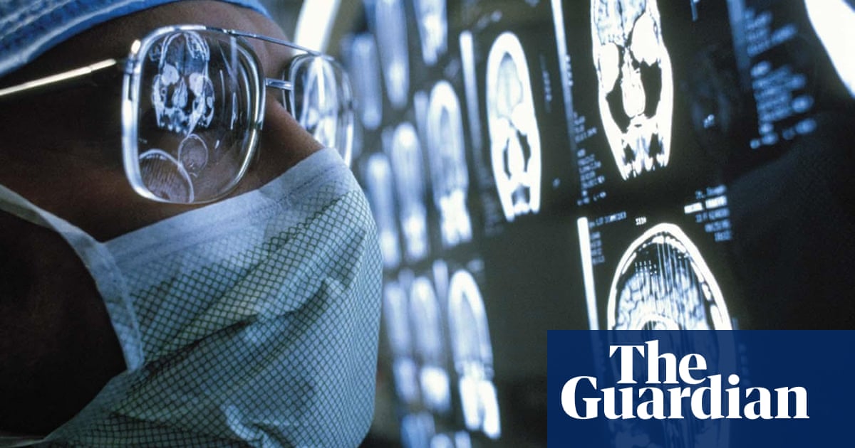 White British brain tumour patients ‘more likely to die in a year’