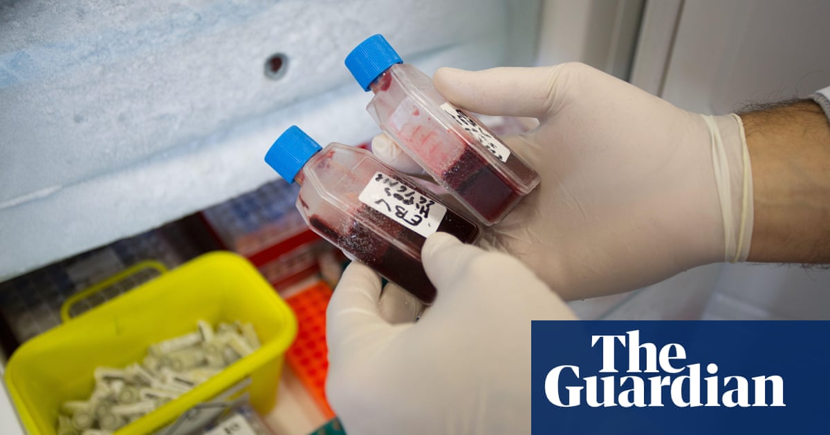 Exclusive: NHS to use AI to identify people at higher risk of hepatitis C