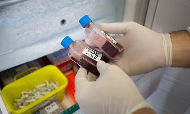 Cryopreserved blood samples with EBV hepatitis viruses status, Centre de Reference National des Hepatites virales, Henri Mondor