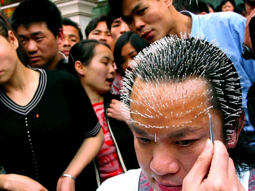Pains and needles: brain scans point to hidden effects of acupuncture | Working in development | The Guardian