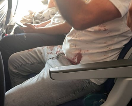 A passenger with blood on his T-shirt onboard the flydubai plane.