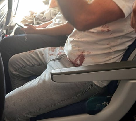 An image showing the torso of an unidentifiable passenger sat in his seat with blood on his shirt.