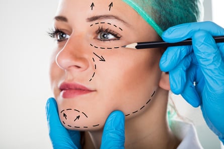 Close-up Of A Surgeon Drawing Perforation Lines On Young Woman’s Face For Plastic Surgery