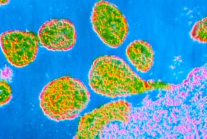 Transmission electron micrograph of Rubella virions.
