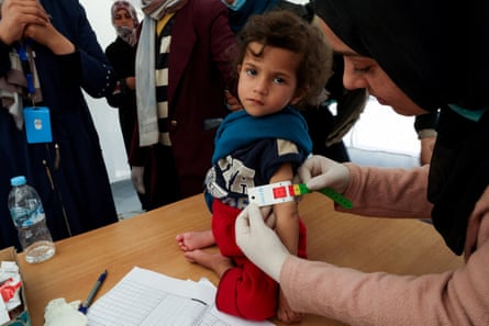 A Palestinian girl has her arm measured for malnutrition