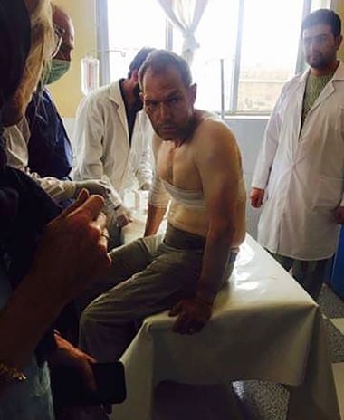 A foreign tourist, wounded during a Taliban militant attack, is treated at hospital.