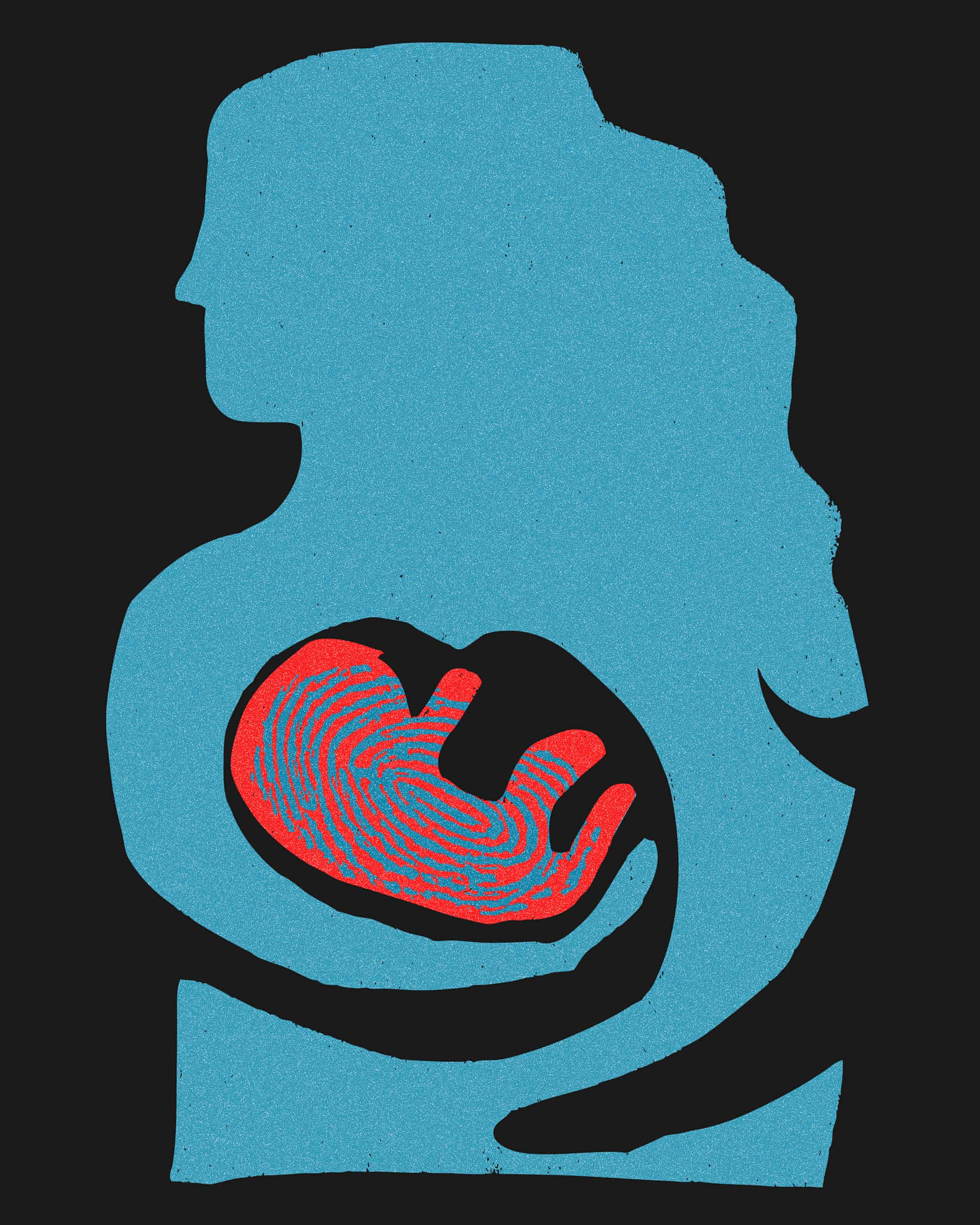 How the anti-abortion movement embraced fringe ‘abolitionists’ and became more punitive (theguardian.com)