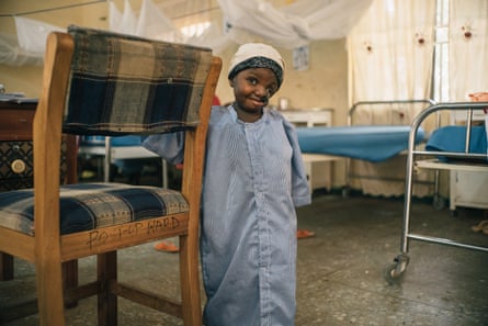 Sakina, a 4-year-old noma survivor from Sokoto state at the Noma Hospital in 2016.