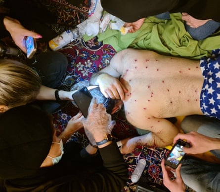 A unnamed man in his thirties who was shot at by Iranian plain-clothed police from a car, according to medics who treated him. Around 30 pellets were removed from his body.