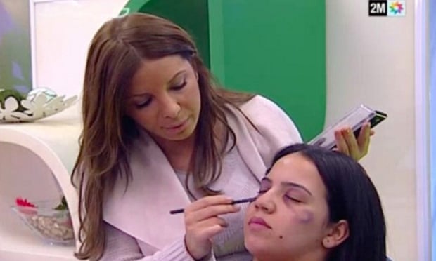 Moroccan TV Channel 2M, which used makeup to create the impression of real bruises, enraged many viewers.